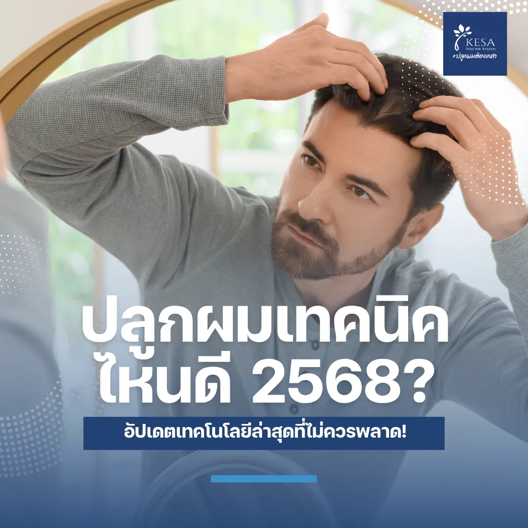 ปลูกผมเทคนิคไหนดี 2568? อัปเดตเทคโนโลยีล่าสุดที่ไม่ควรพลาด! เกศา คลินิก - kesa hair clinic