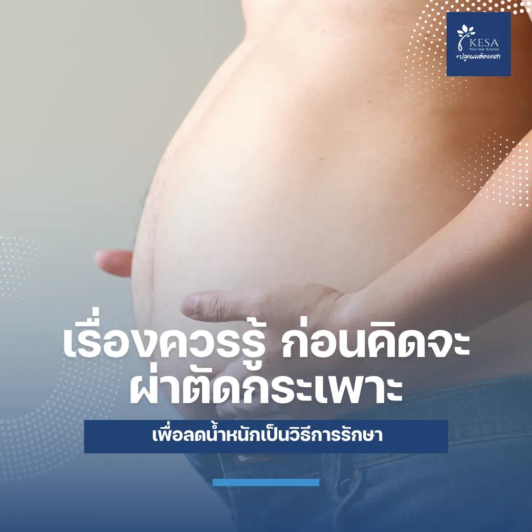 เรื่องควรรู้ ก่อนคิดจะ ผ่าตัดกระเพาะ