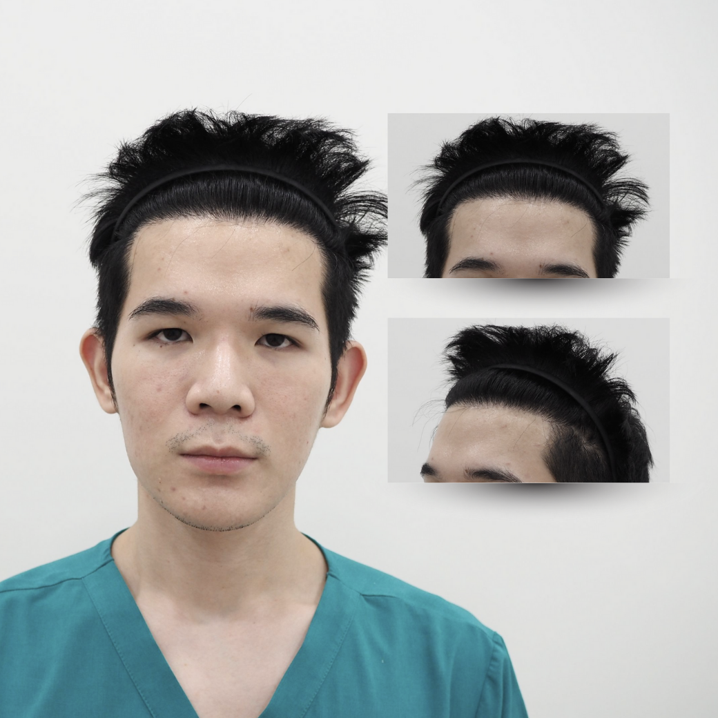 ปลูกผม เกศา คลินิก - kesa hair clinic