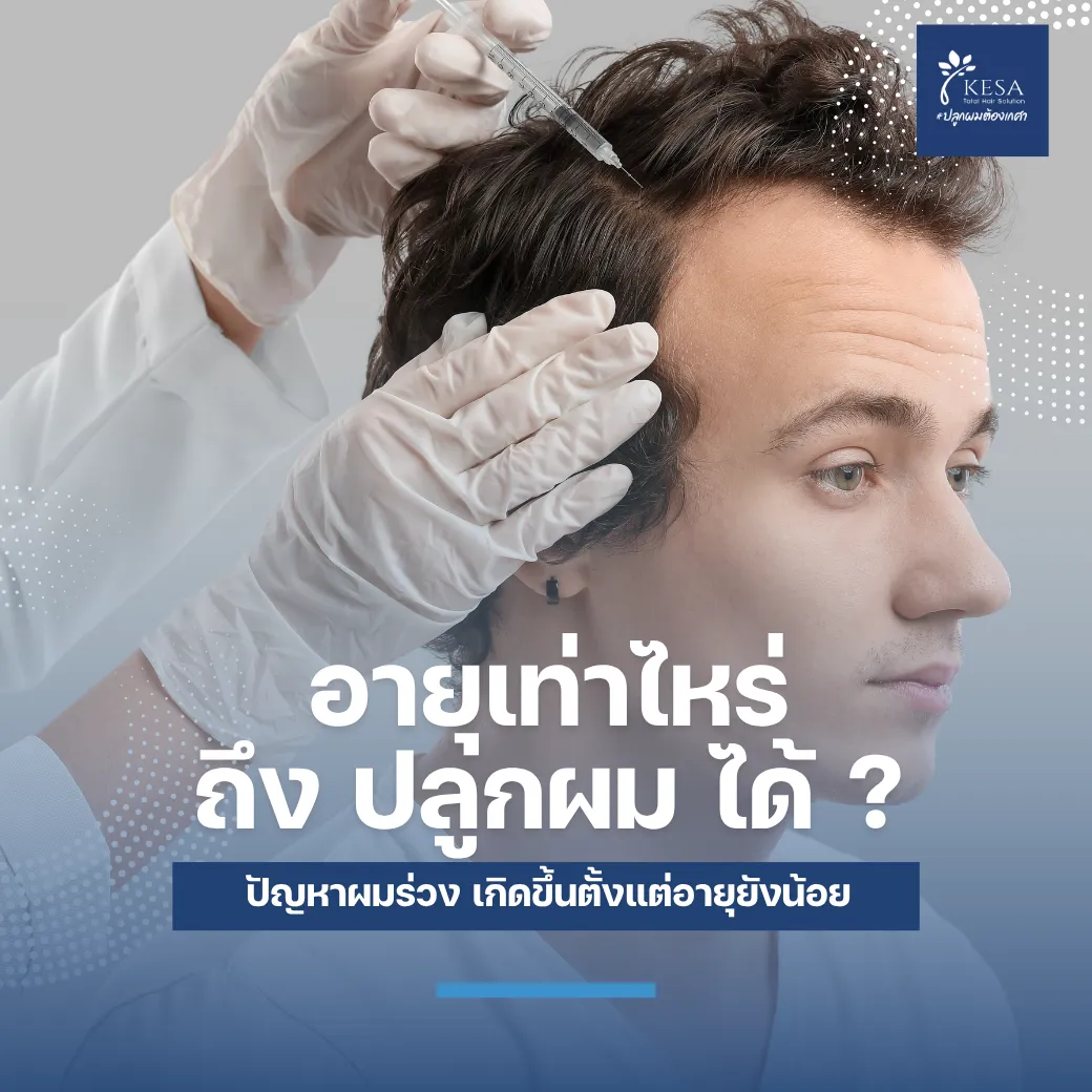 อายุเท่าไหร่ถึง ปลูกผม ได้ ? เกศา คลินิก - kesa hair clinic