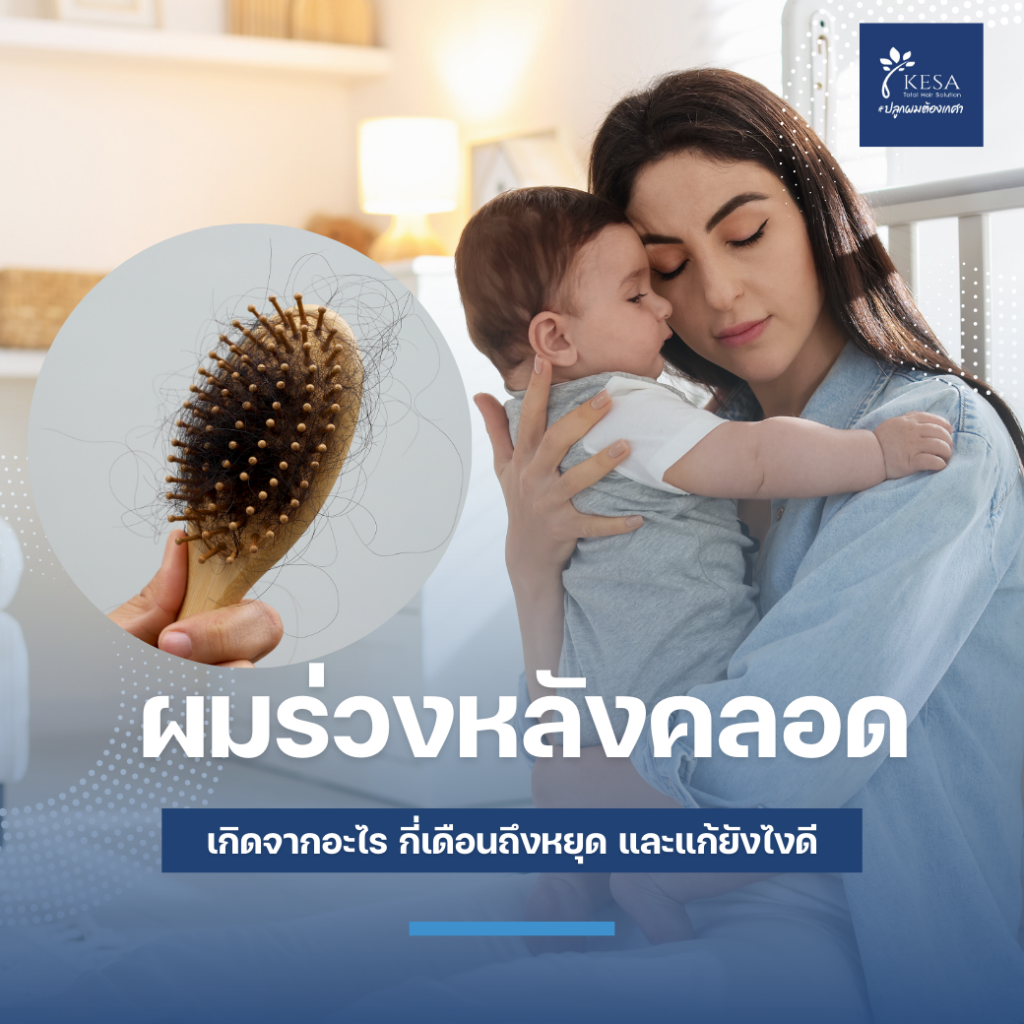 ผมร่วงหลังคลอด เกศา คลินิก - kesa hair clinic