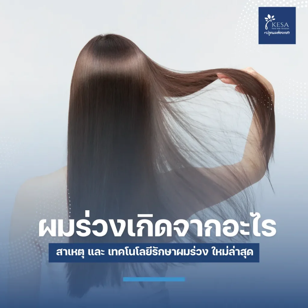 ผมร่วงเกิดจากอะไร – เกศา คลินิก - kesa hair clinic ผมร่วงเกิดจากอะไร เกศา คลินิก - kesa hair clinic