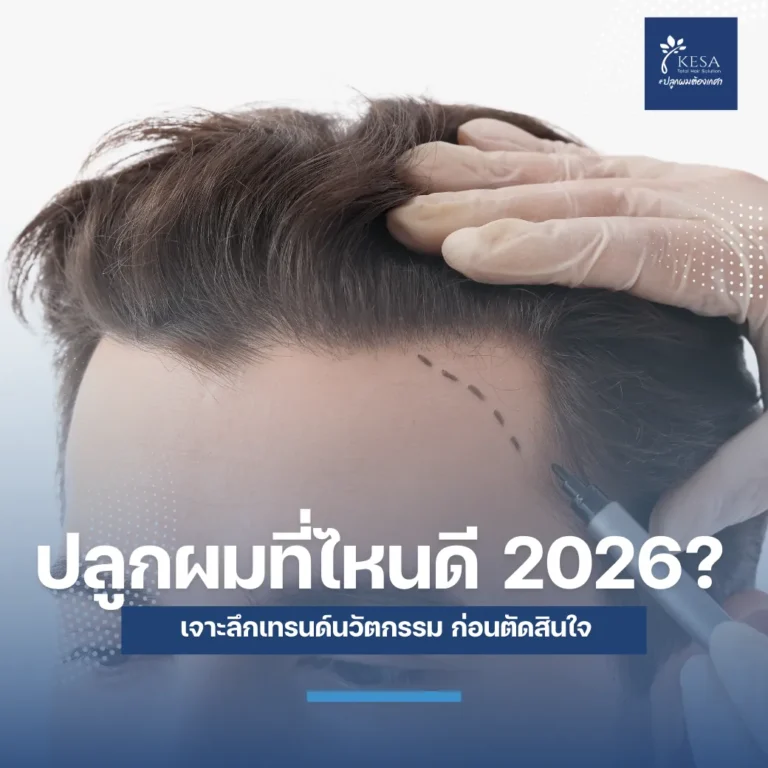 ปลูกผมที่ไหนดี 2026 เกศา คลินิก - kesa hair clinic