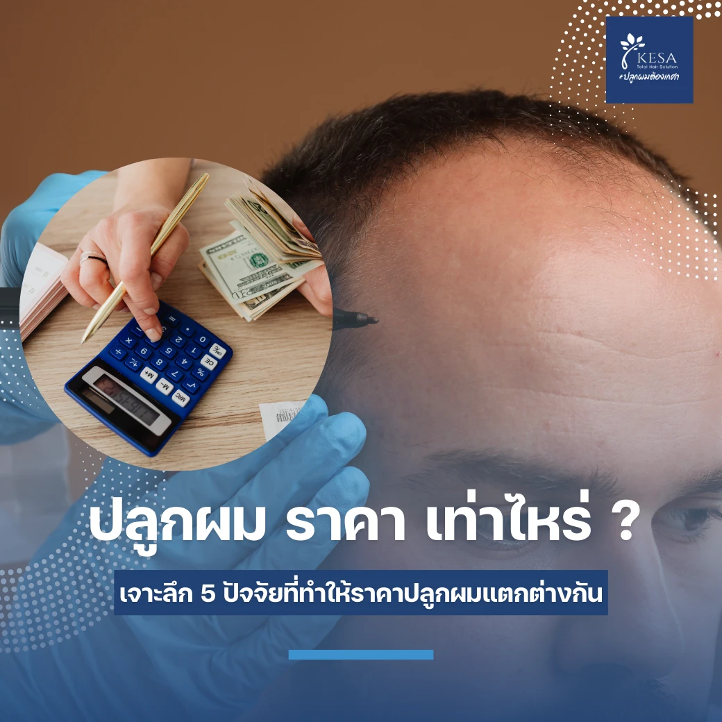 ปลูกผม ราคา เท่าไหร่ ?