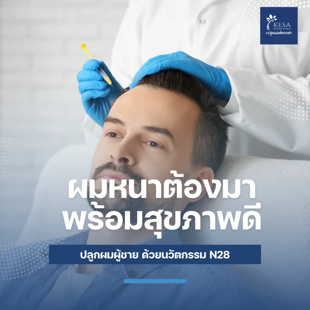 ปลูกผมผู้ชาย ที่ไหนดี เกศา คลินิก - kesa hair clinic