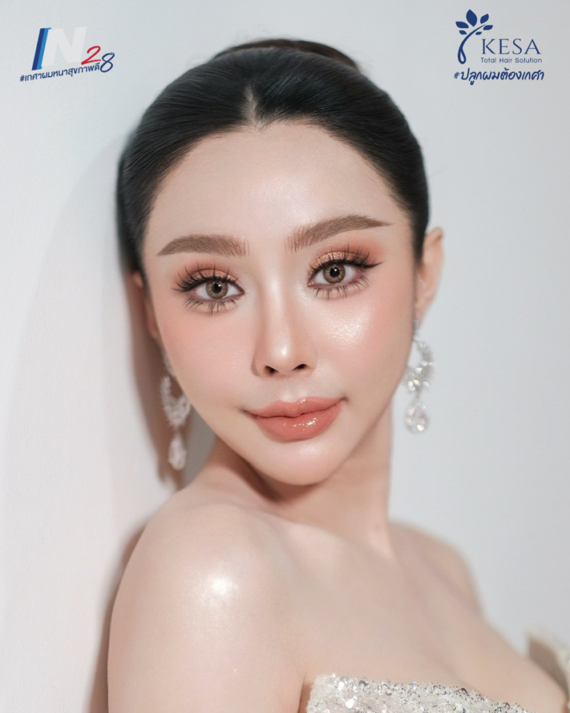 ปลูกผมผู้หญิง N28 เกศา คลินิก - kesa hair clinic เกศา คลินิก - kesa hair clinic