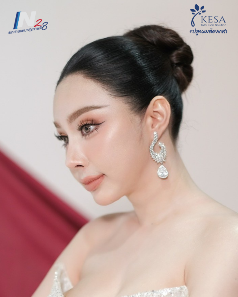 ปลูกผมผู้หญิง เกศา คลินิก - kesa hair clinic