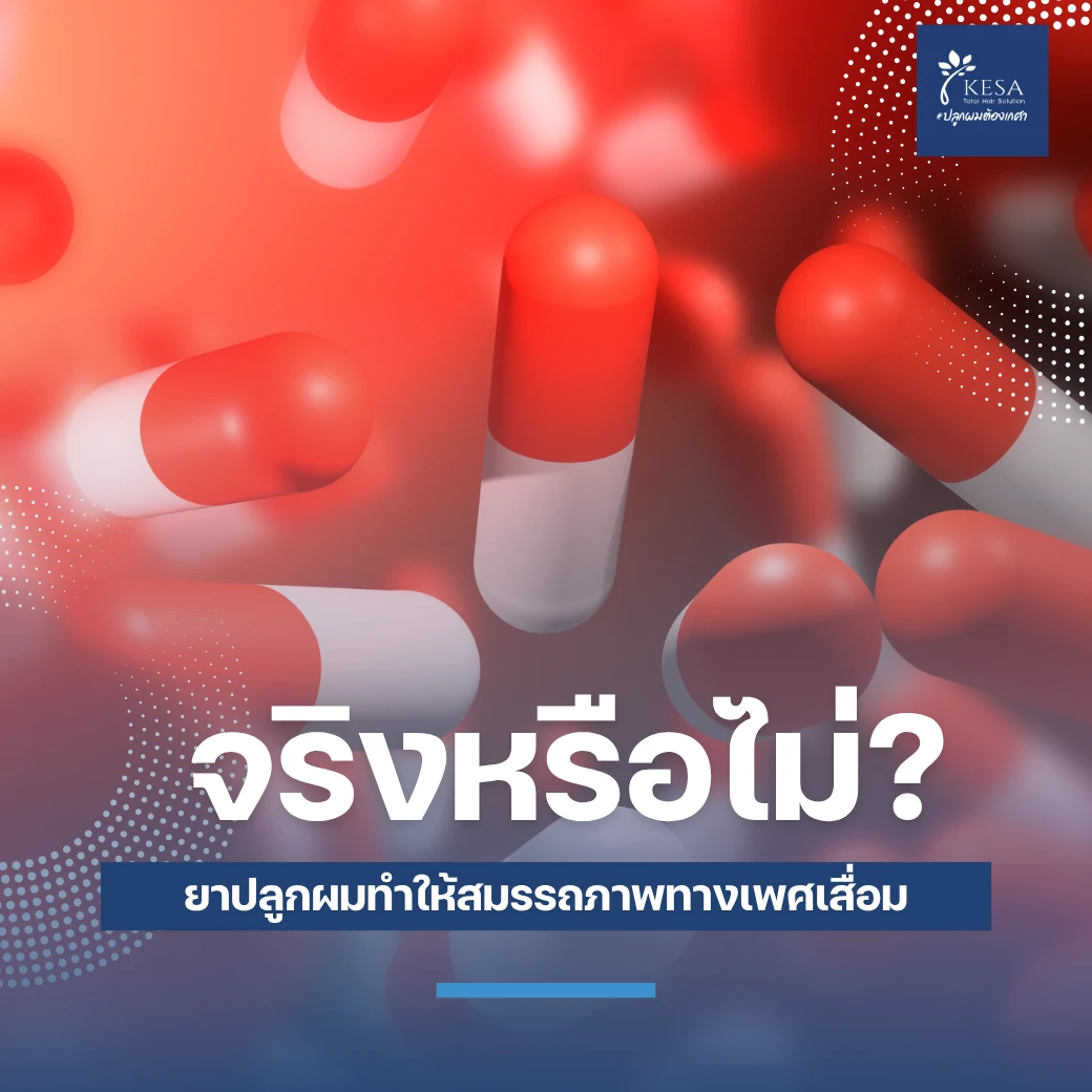 ยาปลูกผมทำให้สมรรถภาพทางเพศเสื่อม