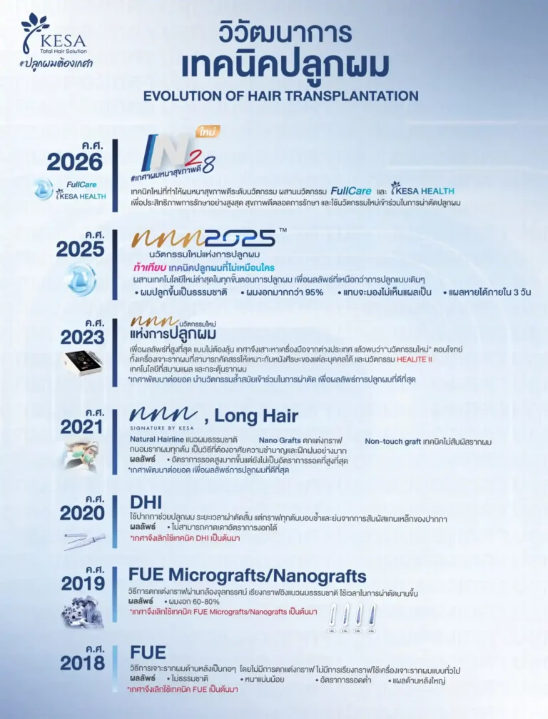นวัตกรรมปลูกผม N28 เกศา คลินิก - kesa hair clinic เกศา คลินิก - kesa hair clinic